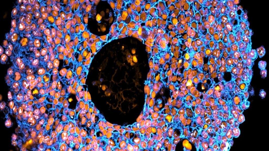 TOPINDIATOURS Breaking ai: World-first 3D placentas print early tissue, test drugs, and re