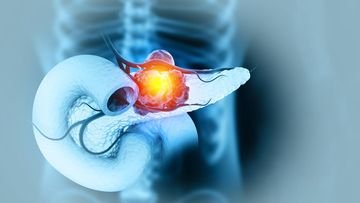 TOPINDIATOURS Breaking kesehatan: Hati-hati! Kesehatan Mulut yang Buruk Bisa Picu Kanker P