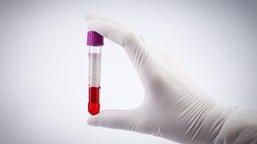 TOPINDIATOURS Breaking kesehatan: Terungkap Golongan Darah yang Lebih Berisiko Kena Stroke