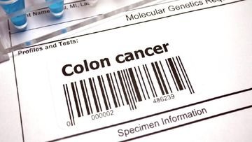 TOPINDIATOURS Breaking kesehatan: Kisah Wanita 24 Tahun Kena Kanker Usus Stadium 4, Ini Ge