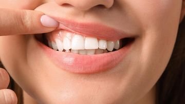 TOPINDIATOURS Update kesehatan: Peneliti Jepang Ungkap Kondisi Gigi Seperti Ini Bisa Tingk