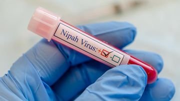 TOPINDIATOURS Hot kesehatan: Dugaan Sumber Penularan Virus Nipah di India, Picu Perawat Te