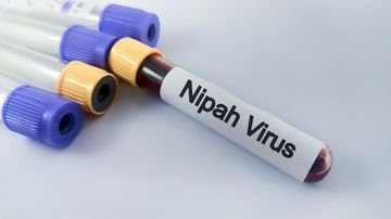 TOPINDIATOURS Hot kesehatan: Kronologi Pasien Meninggal Terpapar Virus Nipah di Bangladesh