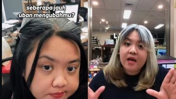 TOPINDIATOURS Breaking kesehatan: Viral Kisah Wanita Jakpus Punya Uban Alami Lebat, Tetap