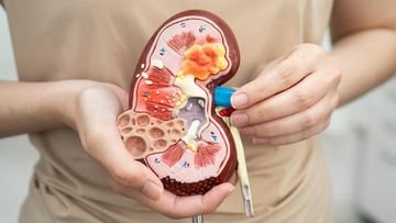 TOPINDIATOURS Update kesehatan: Gejala Kanker Ginjal yang Terlihat dari Urine, Waspadai Ji